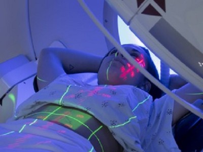 Interviu inedit cu Dr. Călin Doboș despre cancerul de piele Interviu inedit cu Dr. Călin Doboș despre cancerul de piele